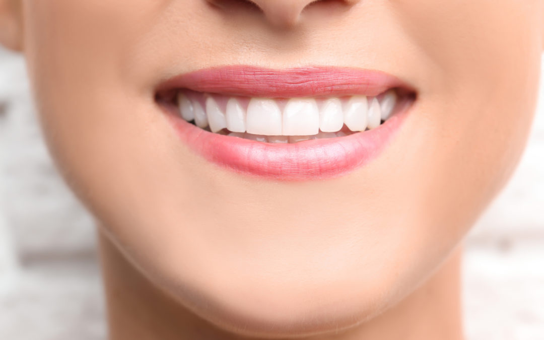 Teeth Bonding When And Why ?