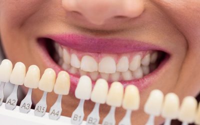 Composite Bonding in Turkey (Dentists & Veneers)